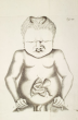 Friedrich Tiedemann's Anatomie der kopflosen Missgeburten